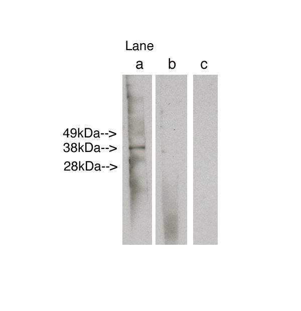 "
Western blot analysis using LAG1 longevity assurance homolog 6 (Cat. # X2303P) at 6ug/ml on human Duodenum lysate 14 ug/lane.  Lane A] antibody alone, Lane B] antibody plus 50 ug blocking peptide (Cat. # X2302B ), Lane C] conjugate alone. Visualized using Pierce West Femto substrate system.  Anti Rabbit secondary used at 1:3.5K dilution(Cat. # X1207M).  Exposure for 1.5 minutes"
